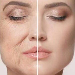 Category: Facial volume