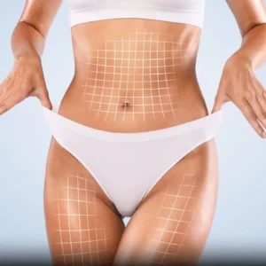 Category: Body contouring