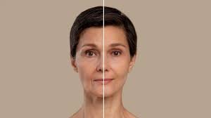 Category: Plasmolifting skincare