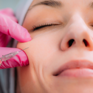 Category: Hyaluron dissolving